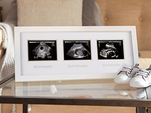 Pearhead Triple Sonogram Pregnancy Keepsake Frame, Watch Baby Grow Through All Three Trimesters - Great Gift for Expecting Parents, Baby Shower Gift, White