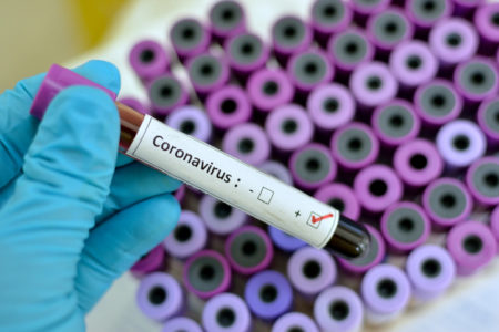 Precautions Against Coronavirus